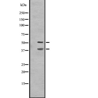 IL27A Antibody - Western blot analysis of IL27A expression in A431 whole cell lysates .