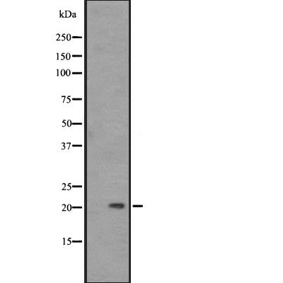 PAEP Antibody - Western blot analysis of PAEP expression in A431 whole cell lysates .