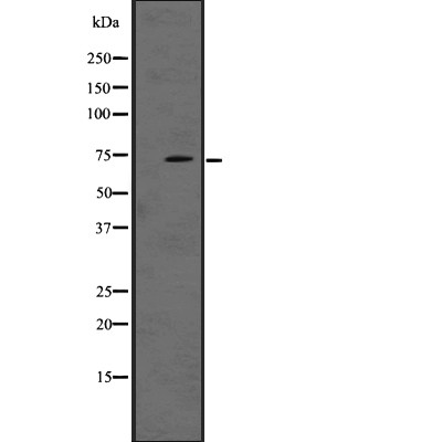 LRRN1 Antibody - Western blot analysis of LRRN1 expression in A431 whole cell lysates .