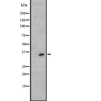 KLK6 Antibody - Western blot analysis of KLK6 expression in A431 whole cell lysates .