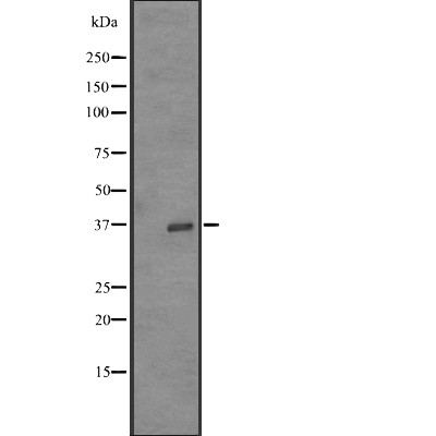 OR52Z1P Antibody - Western blot analysis of OR52Z1P expression in  K562 cell lysates .