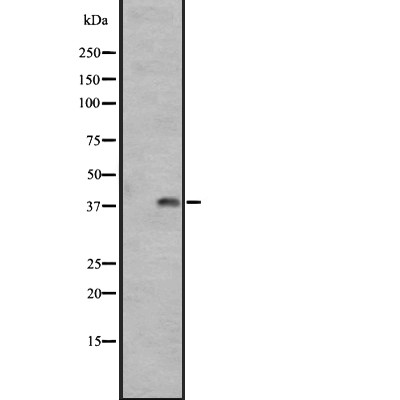 GPR1 Antibody - Western blot analysis of GPR1 expression in A431 whole cell lysates .