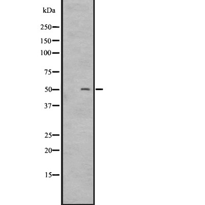 GPR15 Antibody - Western blot analysis of GPR15 expression in A431 whole cell lysates .
