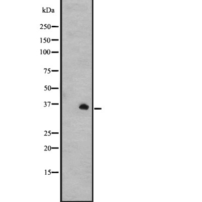 GPR31 Antibody - Western blot analysis of GPR31 expression in A431 whole cell lysates .