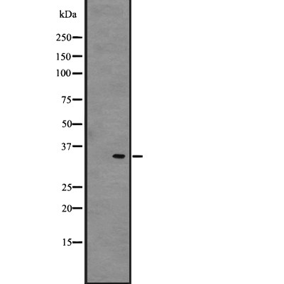GPR32 Antibody - Western blot analysis of GPR32 expression in A431 whole cell lysates .