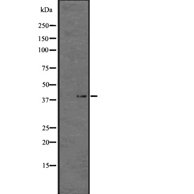 KISS1R Antibody - Western blot analysis of GPR54 expression in HEK293 cells .
