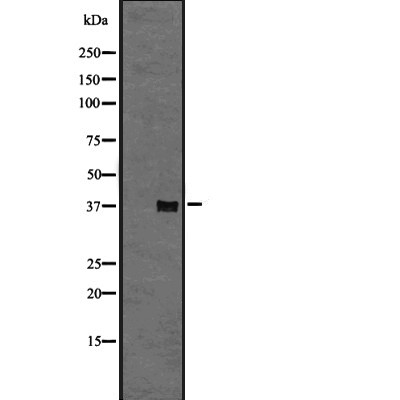 GPR6 Antibody - Western blot analysis of GPR6 expression in A431 whole cell lysates .