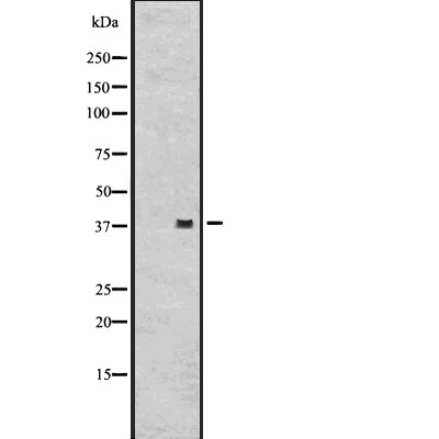 GPR62 Antibody - Western blot analysis of GPR62 expression in  HepG2 whole cell lysate.