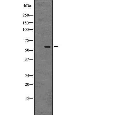 GPR75 Antibody - Western blot analysis of GPR75 expression in A431 whole cell lysates .