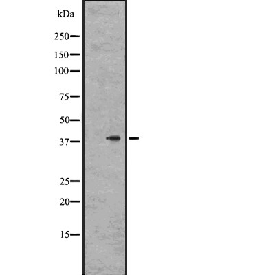 GPR78 Antibody - Western blot analysis of GPR78 expression in  OVCAR 3 cell lysates .