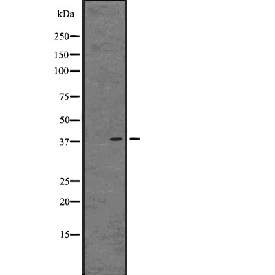 GPR82 Antibody - Western blot analysis of GPR82 expression in  A549 whole cell lysates .