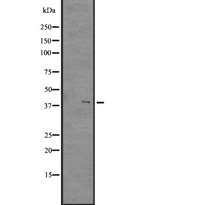 GPR84 Antibody - Western blot analysis of GPR84 expression in A431 whole cell lysates .