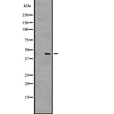 GPR87/GPR95 Antibody - Western blot analysis of GPR87/GPR95 expression in A431 whole cell lysates .