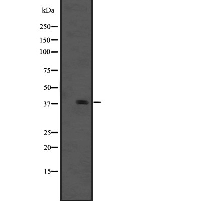 GPR91 Antibody - Western blot analysis of GPR91 expression in HEK293 cells .