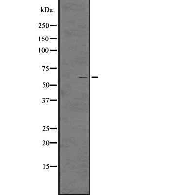 GPR97 Antibody - Western blot analysis of GPR97 expression in  HL60 cell lysates .