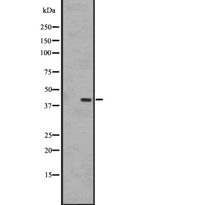 EBI2 Antibody - Western blot analysis of EBI2 expression in A431 whole cell lysates .