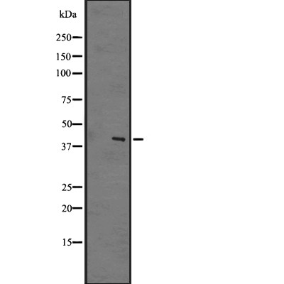 EBI2 Antibody - Western blot analysis of EBI2 expression in A431 whole cell lysates .