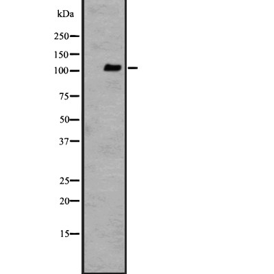 GPR110 Antibody - Western blot analysis of GPR110 expression in Jurkat cell lysates.
