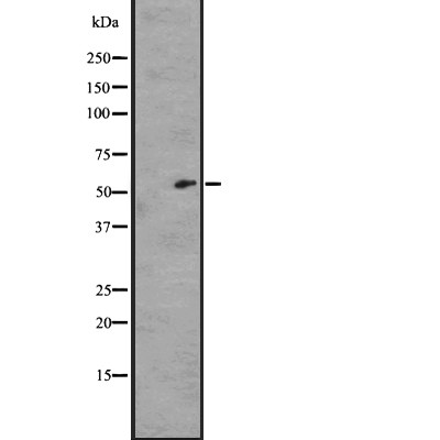 GPR176 Antibody - Western blot analysis of GPR176 expression in A431 whole cell lysates .