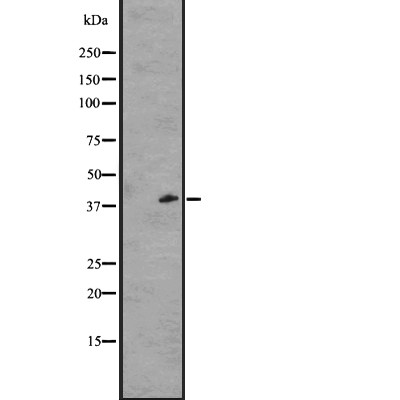 GPR1 Antibody - Western blot analysis of GPR1 expression in A431 whole cell lysates .