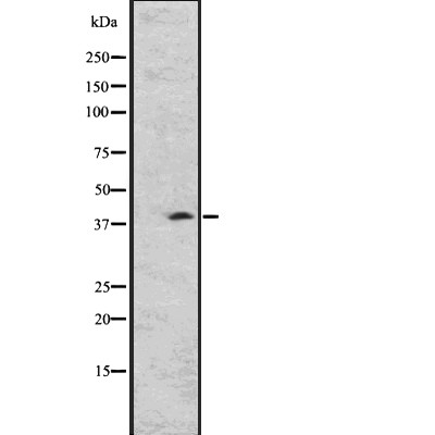 GPR26 Antibody - Western blot analysis of GPR26 expression in A431 whole cell lysates .