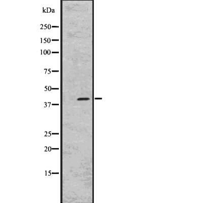 GPR45 Antibody - Western blot analysis of GPR45 expression in  RPMI-8226 whole cell lysates .