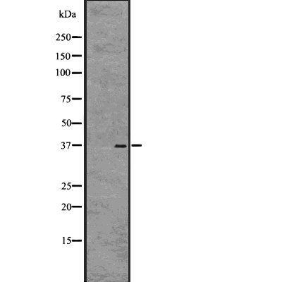 GPR55 Antibody - Western blot analysis of GPR55 expression in HEK293 cells .