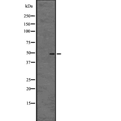 GPR61 Antibody - Western blot analysis of GPR61 expression in  A431 cell lysates .
