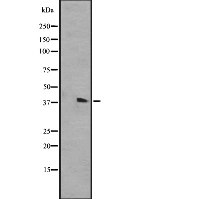 GPR84 Antibody - Western blot analysis of GPR84 expression in A431 whole cell lysates .