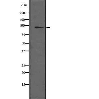 GRM6 Antibody - Western blot analysis of GRM6 expression in A431 whole cell lysates .