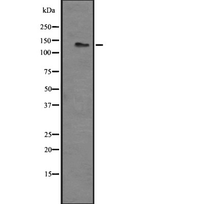 LPHN3 Antibody - Western blot analysis of LPHN3 expression in HEK293 cells .