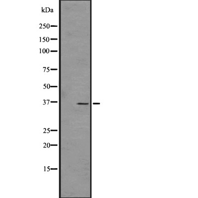 OR4C45 Antibody - Western blot analysis of OR4C45 expression in  HT1080 Whole Cell lysates .