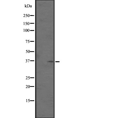 OR51M1 Antibody - Western blot analysis of OR51M1 Antibody expression in SiHa cells lysates.