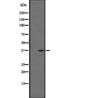 OR1F1 Antibody - Western blot analysis of OR1F1 expression in  K562 cell lysates .