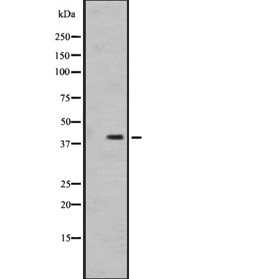 OR1I1 Antibody - Western blot analysis of OR1I1 expression in  MDA-MB231 cell lysates .