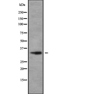 OR2V1 Antibody - Western blot analysis of extracts from ZR-75-1 cells, using OR2V1 Antibody.