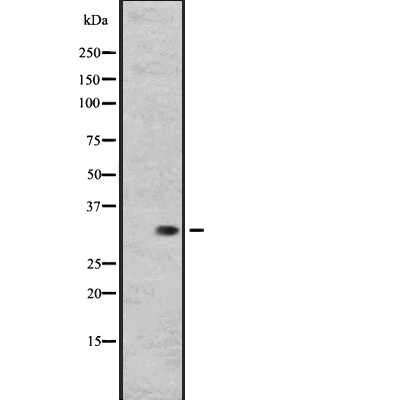RGR Antibody - ACHN whole cell lysate.