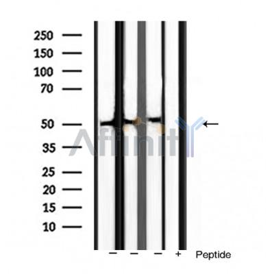 BMP3 Antibody - Western blot analysis of extracts from various samples, using BMP3 Antibody.
