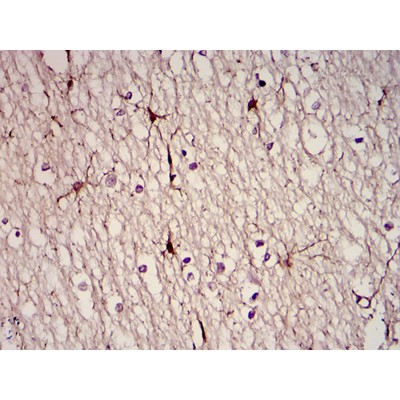 GFAP Antibody - Immunohistochemical analysis of paraffin-embedded brain tissues using GFAP mouse mAb with DAB staining.
