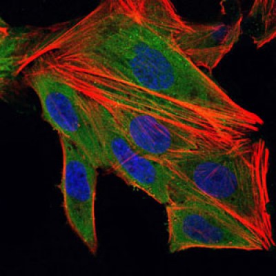 IL1B Antibody - Immunofluorescence analysis of HepG2 cells using IL1B mouse mAb (green).