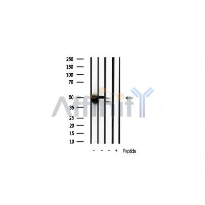 ERK1/2 Antibody - Western blot analysis of extracts from various samples, using ERK1/2 Antibody.