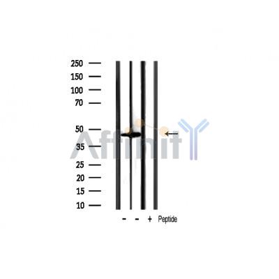 Phospho-GSK3 beta (Ser9) Antibody - Western blot analysis of extracts from various samples, using Phospho-GSK3 beta (Ser9) Antibody.