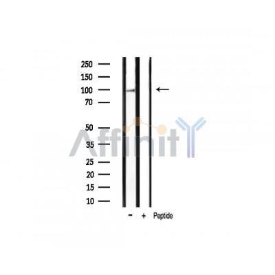 Phospho-Hsp90 beta (Ser254)[Ser255] Antibody - Western blot analysis of extracts from mouse brain tissue, using Phospho-HSP90B (Ser254) Antibody.