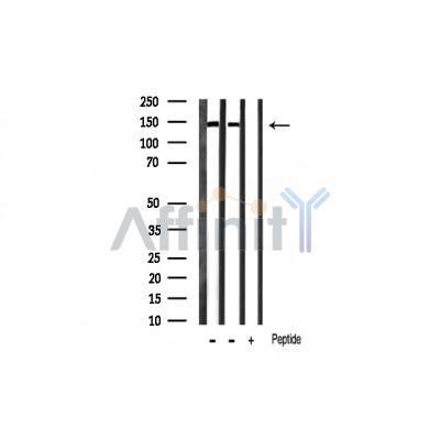 Phospho-Ezrin (Tyr353)[Tyr354] Antibody - Western blot analysis of extracts from mouse brain/rat spleen, using Phospho-Ezrin (Tyr353) Antibody.