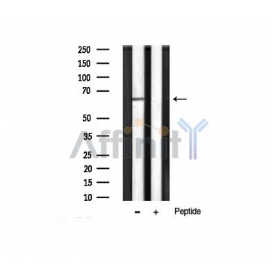 Phospho-AKT1 (Thr450) Antibody - Western blot analysis of Akt1 phosphorylation expression in Hela whole cell lysates,The lane on the right was treated with the antigen-specific peptide.