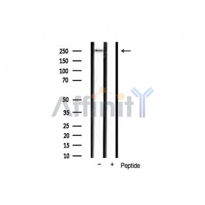 Phospho-mTOR (Ser2448) Antibody - Western blot analysis of mTOR phosphorylation expression in mouse liver tissue lysates,The lane on the right was treated with the antigen-specific peptide.