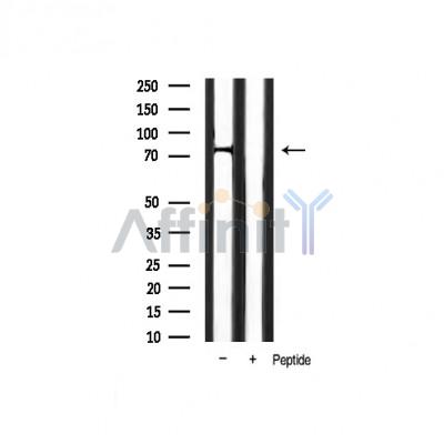 Phospho-FOXO1A (Ser319) Antibody - Western blot analysis of FKHR phosphorylation expression in mouse muscle tissue lysates,The lane on the right was treated with the antigen-specific peptide.