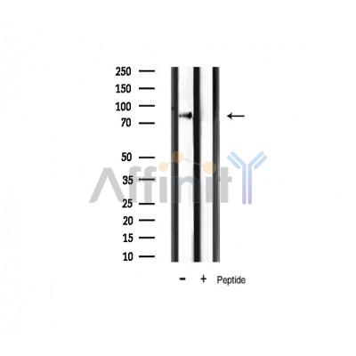 IKK alpha/ beta Antibody - Western blot analysis of IKK-alpha/beta expression in mouse muscle tissue lysates,The lane on the right was treated with the antigen-specific peptide.