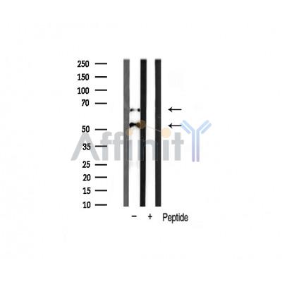 CaMKII beta/ gamma/ delta Antibody - Western blot analysis of CaMK2-beta/gamma/delta expression in Rat spleen tissue lysates,The lane on the right was treated with the antigen-specific peptide.