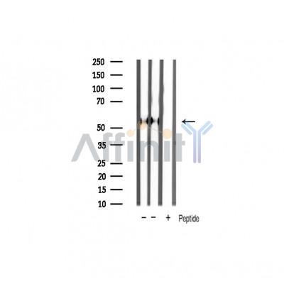 Smad2 Antibody - Western blot analysis of extracts from various samples, using Smad2 Antibody.